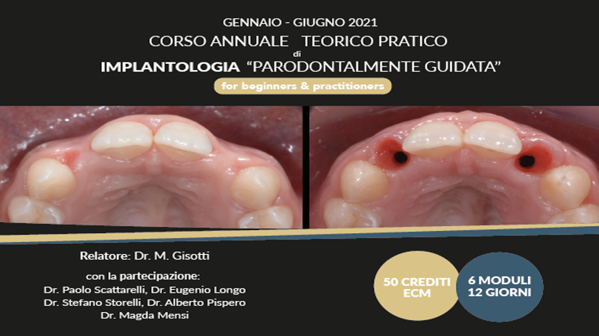 CORSO ANNUALE TEORICO PRATICO di IMPLANTOLOGIA PARODONTALMENTE GUIDATA