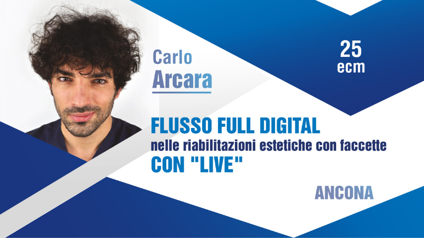 FLUSSO FULL DIGITAL NELLE RIABILITAZIONI ESTETICHE CON FACCETTE