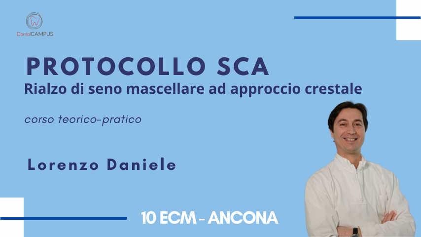 PROTOCOLLO SCA - Rialzo di seno mascellare ad approccio crestale- corso teorico-pratico
