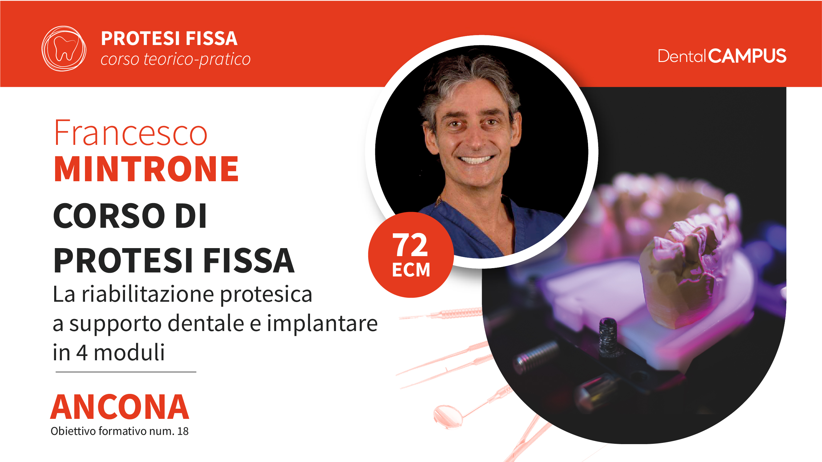 CORSO DI PROTESI FISSA: La riabilitazione protesica a supporto dentale e implantare