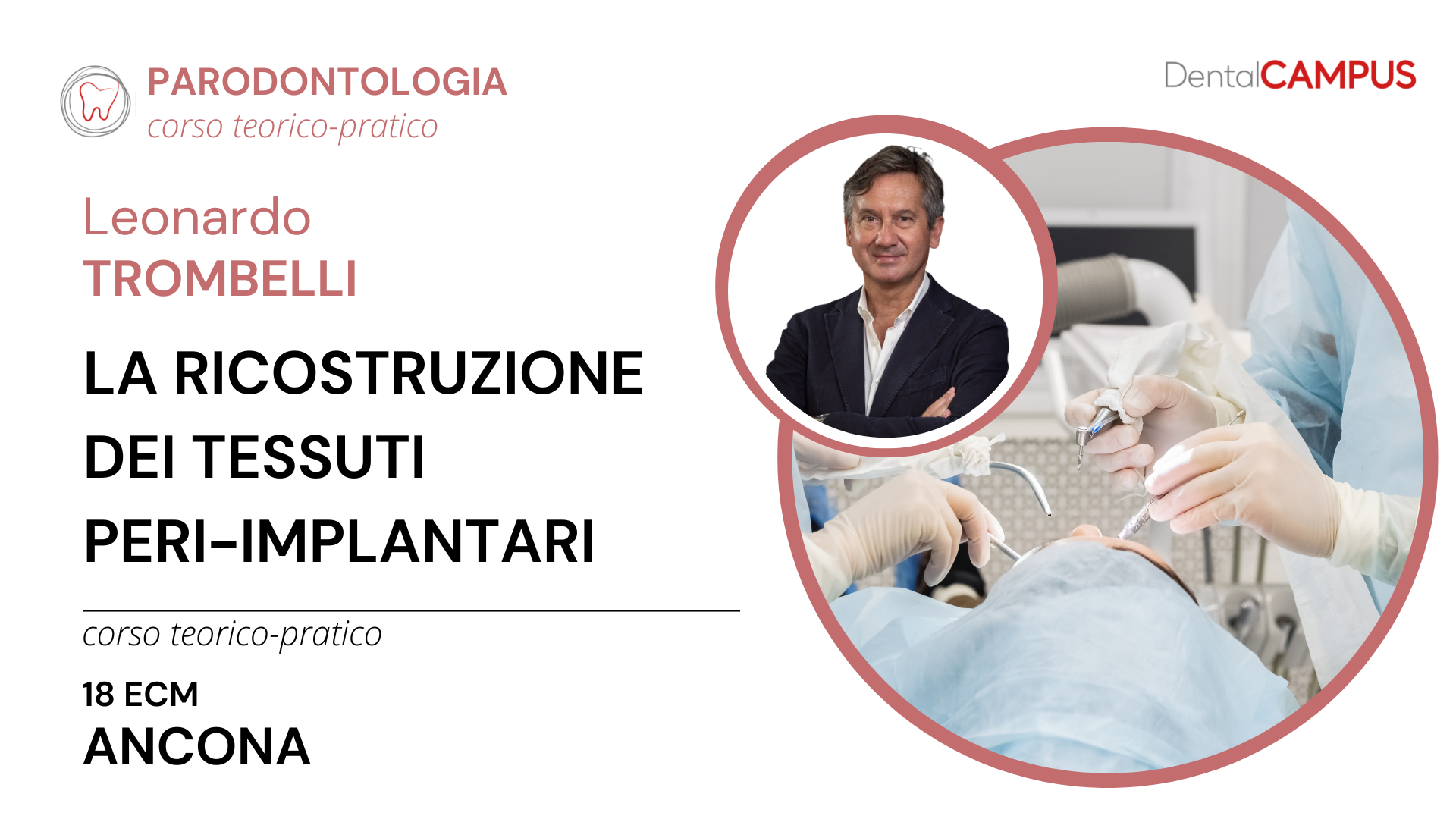LA RICOSTRUZIONE DEI TESSUTI PERI-IMPLANTARI