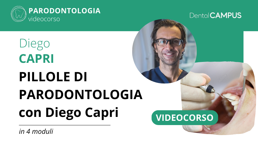 PILLOLE DI PARODONTOLOGIA con Diego Capri