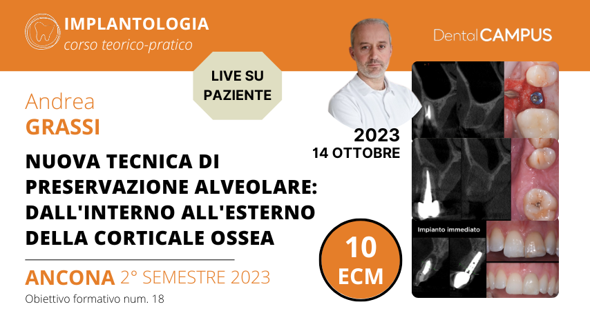 Nuova Tecnica di Preservazione Alveolare: dall’interno all’esterno della corticale ossea