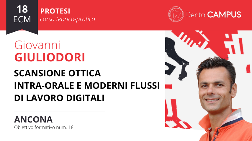 Faccette - Dr. Domenico Di Croce. Implantologia digitale