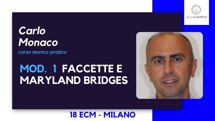 FACCETTE E MARYLAND BRIDGES - corso teorico pratico