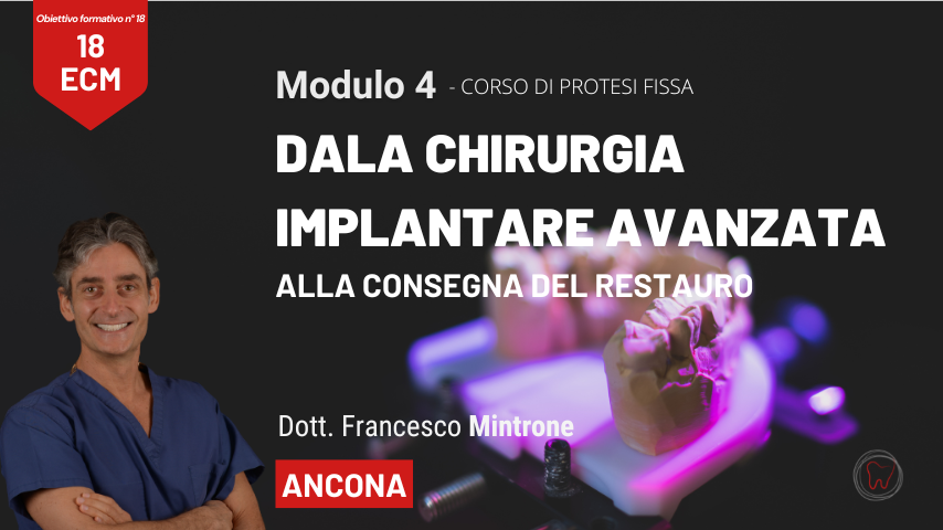 Dalla chirurgia impiantare avanzata alla consegna del restauro